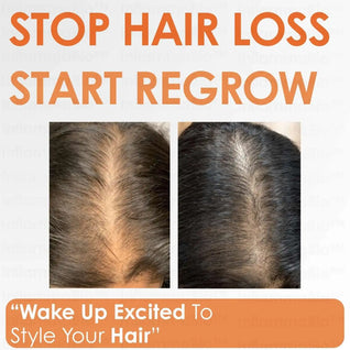 Pumpkin Seed Oil + Saw Palmetto Dual-Action DHT-Blocker