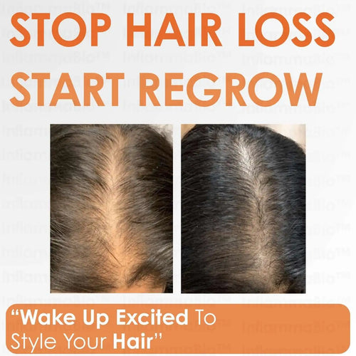 Pumpkin Seed Oil + Saw Palmetto Dual-Action DHT-Blocker