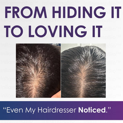 InflammaBio™ Hair Growth Accelerator (40X Biotin) Soft Chew