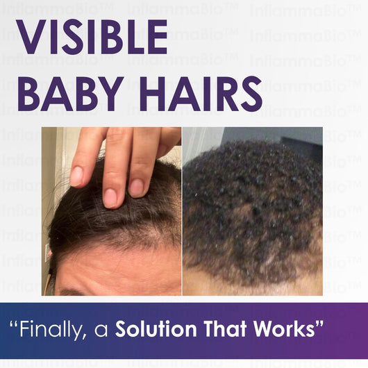 InflammaBio™ Hair Growth Accelerator (40X Biotin) Soft Chew