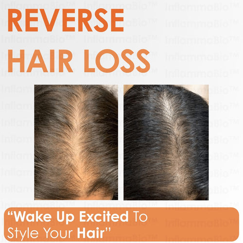 InflammaBio™ Pumpkin Seed Oil & Saw Palmetto. Dual-Action DHT-Blocker