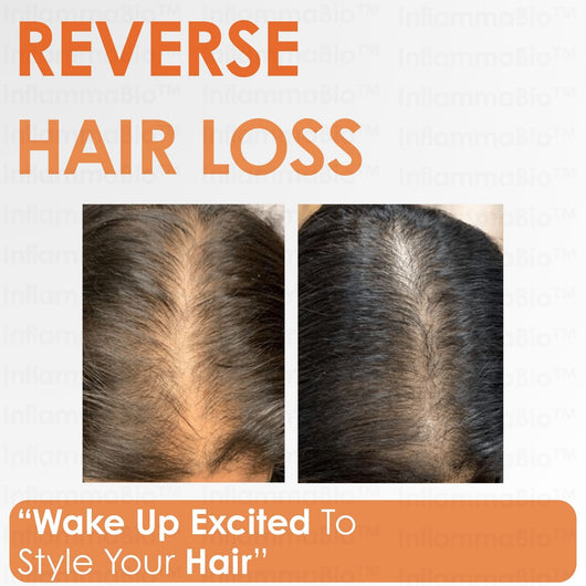 InflammaBio™ Pumpkin Seed Oil & Saw Palmetto. Dual-Action DHT-Blocker